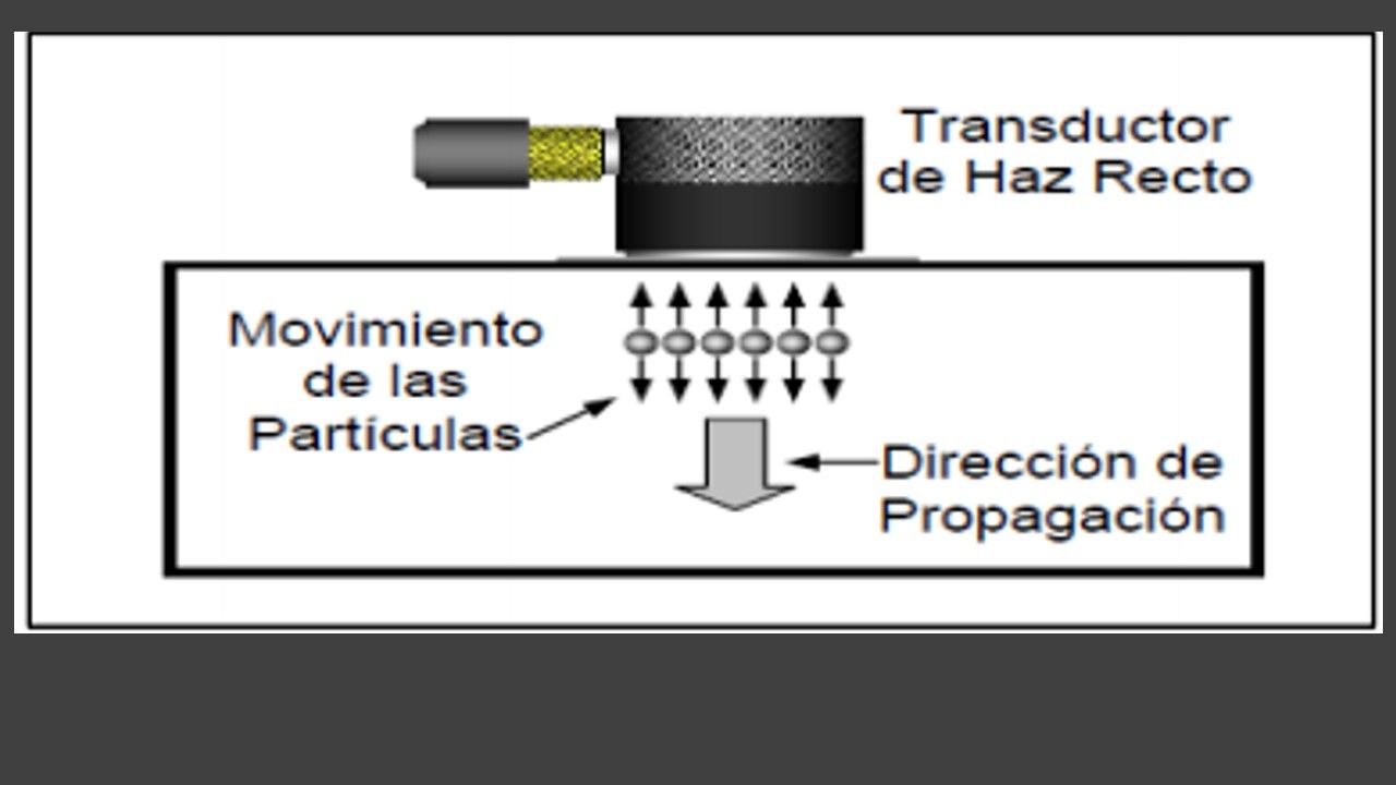 Ultrasonido